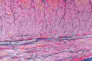 Smooth Muscle Composite Microscope Slide