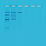 Restriction Enzyme Analysis of DNA Advanced Inquiry Lab Kit for AP* Biology