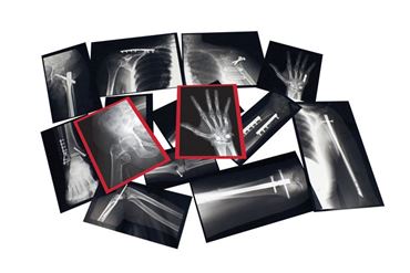 Fixed Bones X-Rays for Anatomy and Physiology