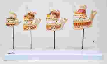 3B Anatomical Model - Dentition Development Model 3B Anatomical Model - Dentition Development Model