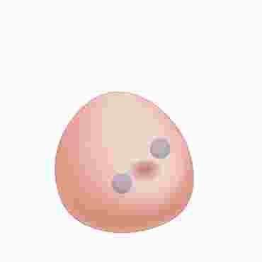 biopsies, aspirations, injections, punctures