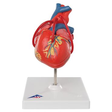 Classic Heart with Bypass, 2-Part Model