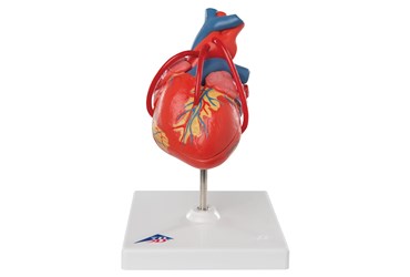 Classic Heart with Bypass, 2-Part Model