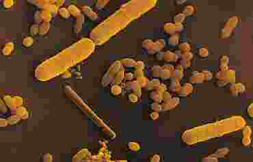 Escherichia coli Bacterial Culture for Microbiology Laboratory Studies