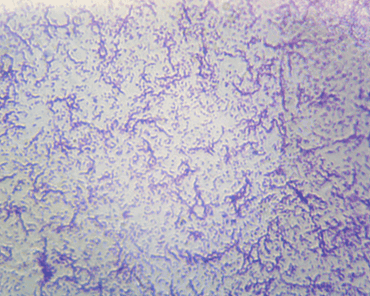 Mixed Bacteria Microscope Slide
