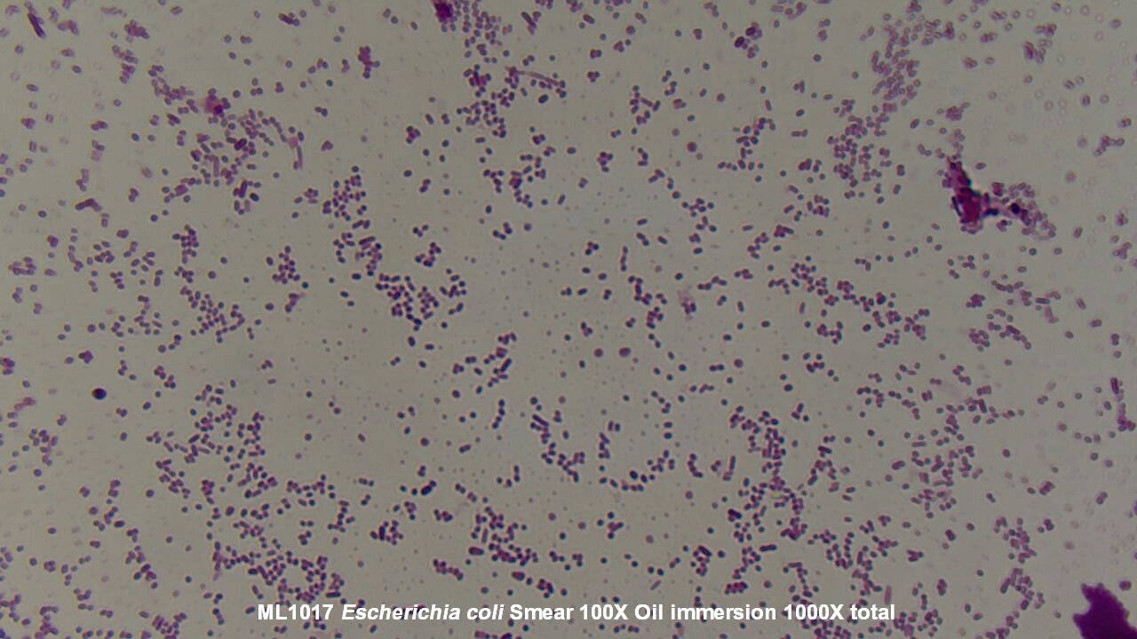 Slide Escherichia Coli