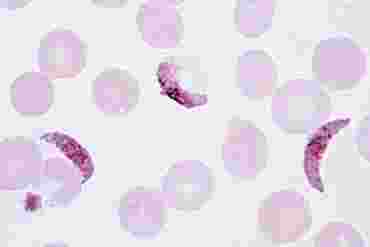 Plasmodium Smear Microscope Slide