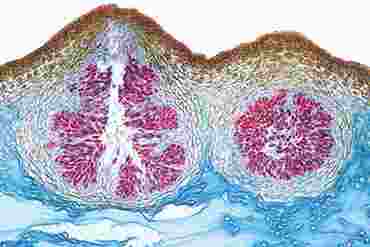 Fucus Microscope Slide, Male Conceptacle