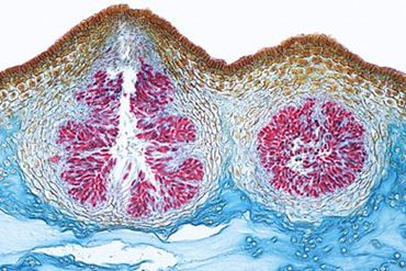 Fucus Microscope Slide, Male Conceptacle