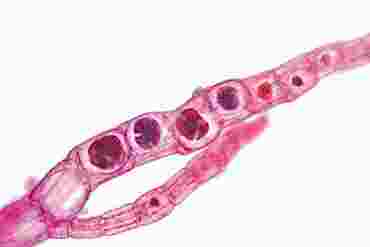 Polysiphonia Microscope Slide, Marine Species