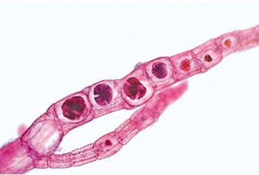 Polysiphonia Microscope Slide, Marine Species