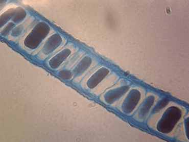 Polysiphonia Microscope Slide, Marine Species