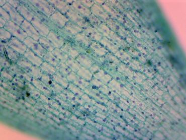 Elodea canadensis Leaf Microscope Slide