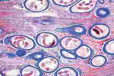 Trichinella Microscope Slide