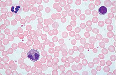 Normal Human Blood Microscope Slide, Giemsa Stain