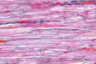 Cardiac Heart Muscle Microscope Slide