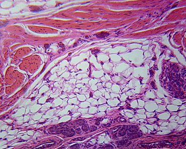 Human Skin Microscope Slide