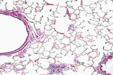 Human Lung Microscope Slide
