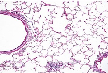 Human Lung Microscope Slide
