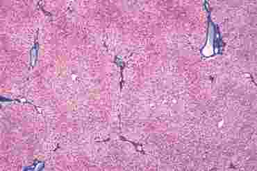 Human Liver Microscope Slide