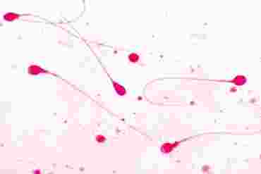 Human Sperm Microscope Slide