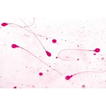 Human Sperm Microscope Slide