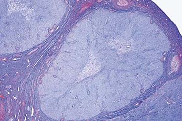Ovary with Corpus Luteum Microscope Slide