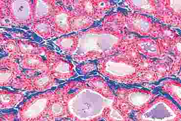Thyroid Microscope Slide