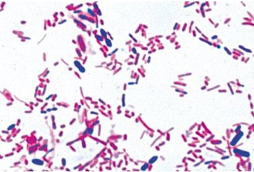 Human Intestine Bacteria Smear Microscope Slide