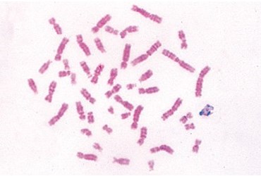 Male Human Chromosome Microscope Slide