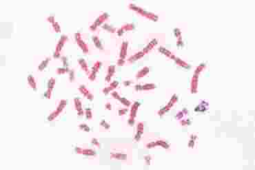 Male Human Chromosome Microscope Slide