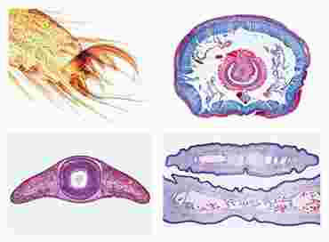 Invertebrate Zoology General Slide Set for Biology and Life Science