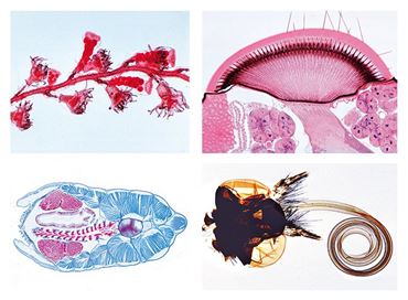 Invertebrate Zoology General Slide Set for Biology and Life Science