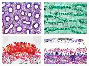 Cryptogamae Microscope Slide Sets