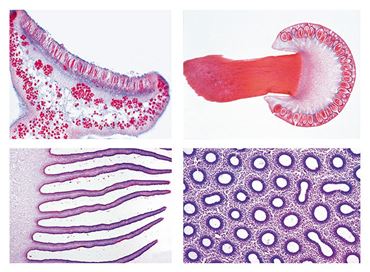 Fungi and Lichen Slide Set for Biology and Life Science