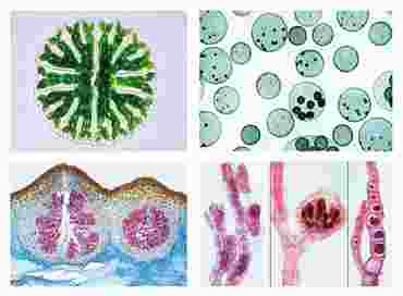 Algae Slide Set for Biology and Life Science