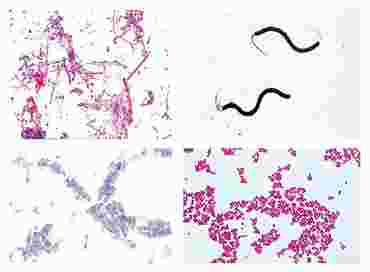 Bacteria Slide Sets