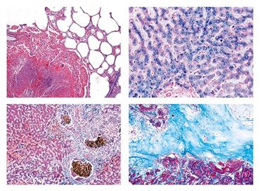 Human Pathology Slide Sets