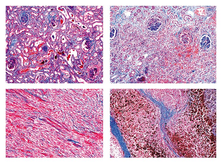 online slides pathology