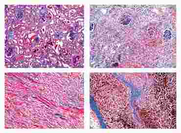 Human Pathology Slide Sets