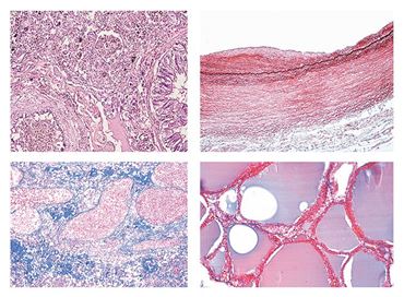 Human Pathology Slide Sets