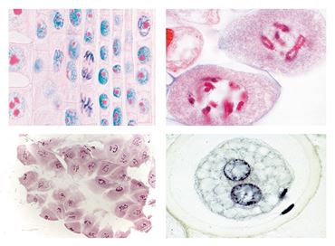 Mitosis and Meiosis Slide Sets
