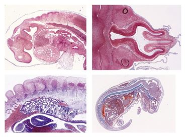 Embryology Slide Sets