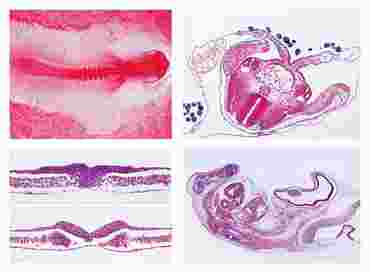 Embryology Slide Sets