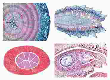 Gymnospermae Slide Set for Biology and Life Science