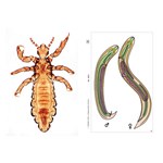 Parasites Multimedia Microscope Slide Instructor Package for Biology and Life Science