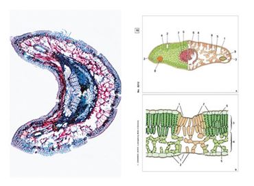Environmental Damages Multimedia Microscope Slide Instructor Package for Biology and Life Science
